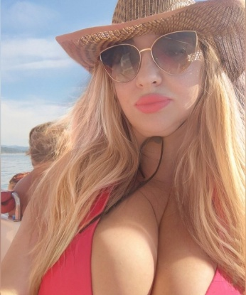 Альбина